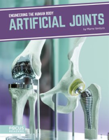 Artificial_Joints